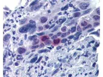 Anti-Mlf1 Interacting Protein (phospho Thr78) antibody used in IHC (Paraffin sections) (IHC-P). GTX48727