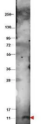 Anti-CXCL10 / IP10 antibody used in Western Blot (WB). GTX48762