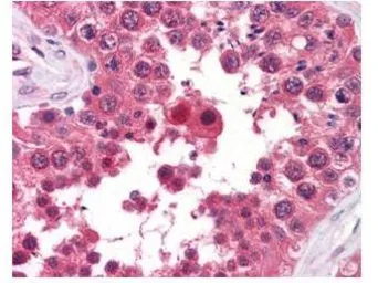 Anti-AHA-1 antibody [25F2.D9] used in IHC (Paraffin sections) (IHC-P). GTX48775