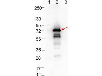 Anti-Borrelia burgdorferi Osp A antibody used in Western Blot (WB). GTX48804