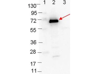 Anti-Borrelia burgdorferi Osp C antibody used in Western Blot (WB). GTX48806