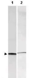 Anti-S100 antibody used in Western Blot (WB). GTX48819