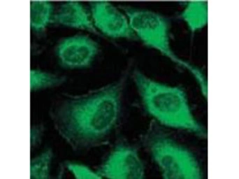 Anti-pan Cytokeratin antibody [C-11] used in Immunocytochemistry/ Immunofluorescence (ICC/IF). GTX48825