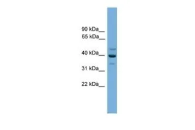 Anti-BNIPL antibody, Internal used in Western Blot (WB). GTX48910