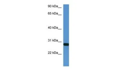 Anti-HOXB1 antibody, C-term used in Western Blot (WB). GTX48939