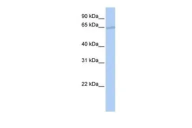 Anti-p66 beta antibody, N-term used in Western Blot (WB). GTX48952