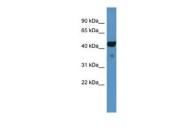 Anti-Fa2h antibody, C-term used in Western Blot (WB). GTX48954