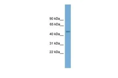 Anti-FOXD4 antibody, N-term used in Western Blot (WB). GTX48975