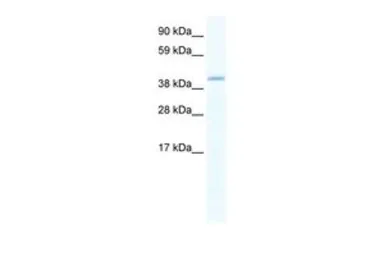 Anti-GATA5 antibody, C-term used in Western Blot (WB). GTX48976