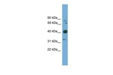Anti-FOXQ1 antibody, N-term used in Western Blot (WB). GTX48977