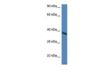 Anti-HAO2 antibody, Internal used in Western Blot (WB). GTX49010