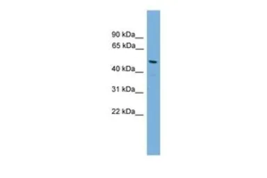 Anti-Connexin 50 / GJA8 antibody, N-term used in Western Blot (WB). GTX49015