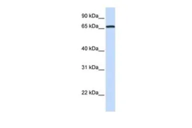 Anti-MED26 antibody, N-term used in Western Blot (WB). GTX49066