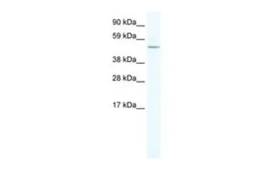 Anti-LASS4 antibody, N-term used in Western Blot (WB). GTX49079