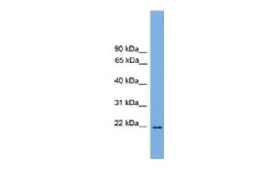Anti-JDP2 antibody, C-term used in Western Blot (WB). GTX49081