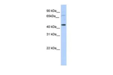 Anti-LMX1A antibody, C-term used in Western Blot (WB). GTX49084