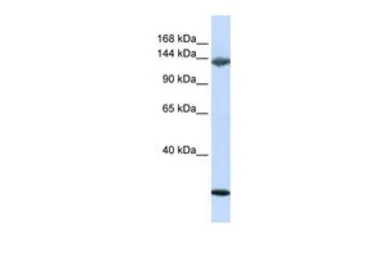 Anti-Jagged 2 antibody, N-term used in Western Blot (WB). GTX49093