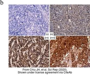 Anti-MEGF11 antibody, Internal used in Immunohistochemistry (IHC). GTX49102