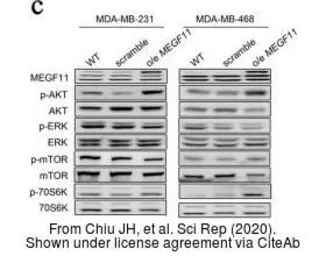 Anti-MEGF11 antibody, Internal used in Western Blot (WB). GTX49102