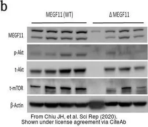 Anti-MEGF11 antibody, Internal used in Western Blot (WB). GTX49102