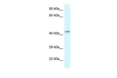 Anti-MECR antibody, C-term used in Western Blot (WB). GTX49121
