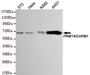 Anti-CARM1 antibody [2B9-H11-H10] used in Western Blot (WB). GTX49171