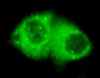 Anti-Cytokeratin 7 antibody [4G9-D8-H6] used in Immunocytochemistry/ Immunofluorescence (ICC/IF). GTX49182