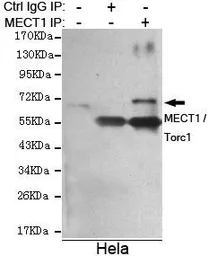 Anti-TORC1 antibody [3D7-E5-D9] used in Immunoprecipitation (IP). GTX49232