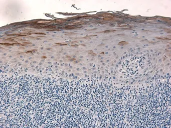 Anti-beta 2 Defensin antibody used in IHC (Paraffin sections) (IHC-P). GTX49324