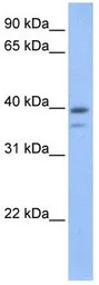Anti-VPS26B antibody used in Western Blot (WB). GTX49354