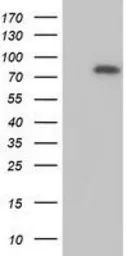 Anti-MTMR2 antibody [5G5] used in Western Blot (WB). GTX49358