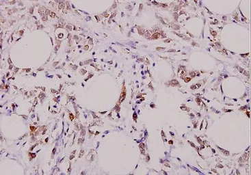 Anti-Caspase 3 p17 subunit antibody used in IHC (Paraffin sections) (IHC-P). GTX49360