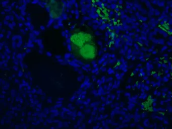 Anti-C4C antibody [99-72-18] used in Immunocytochemistry/ Immunofluorescence (ICC/IF). GTX49368