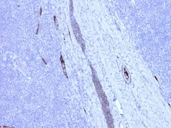 Anti-C4C antibody [99-72-18] used in Immunohistochemistry (IHC). GTX49368