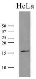 Anti-SUMO2 antibody [AT10F1] used in Western Blot (WB). GTX50000