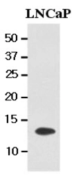 Anti-TBCA antibody [AT1A5] used in Western Blot (WB). GTX50016