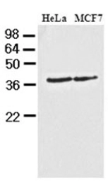 Anti-Casein Kinase 1 alpha antibody [AT2E2] used in Western Blot (WB). GTX50020