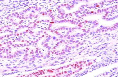 Anti-DACT3 antibody [2A5] used in IHC (Paraffin sections) (IHC-P). GTX50032