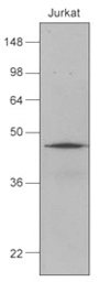Anti-Hsp40 antibody [k1C7] used in Western Blot (WB). GTX50059