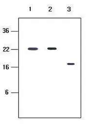 Anti-KIR2D antibody [2H6] used in Western Blot (WB). GTX50072