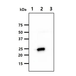 Anti-KIR2DL3 antibody [190IIC311] used in  (). GTX50078