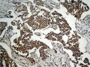 Anti-GSK3 beta (phospho Ser9) antibody used in IHC (Paraffin sections) (IHC-P). GTX50090