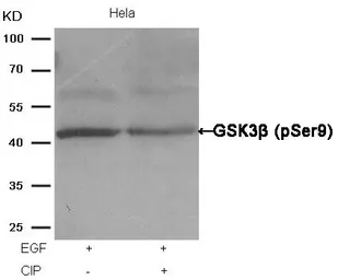 Anti-GSK3 beta (phospho Ser9) antibody used in Western Blot (WB). GTX50090