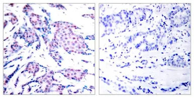 Anti-c-Jun (phospho Thr93) antibody used in IHC (Paraffin sections) (IHC-P). GTX50101