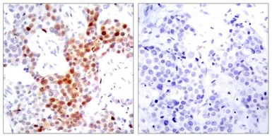 Anti-ATF2 (phospho Thr69) antibody used in IHC (Paraffin sections) (IHC-P). GTX50108