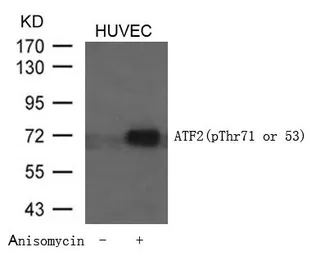 Anti-ATF2 (phospho Thr71) antibody used in Western Blot (WB). GTX50109