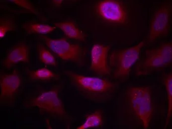 Anti-ATF2 (phospho Thr73) antibody used in Immunocytochemistry/ Immunofluorescence (ICC/IF). GTX50110