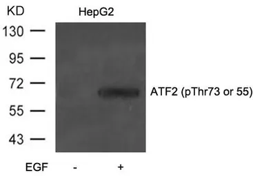 Anti-ATF2 (phospho Thr73) antibody used in Western Blot (WB). GTX50110