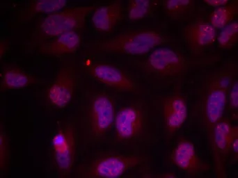 Anti-c-Myc (phospho Thr358) antibody used in Immunocytochemistry/ Immunofluorescence (ICC/IF). GTX50112