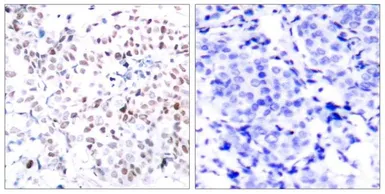 Anti-c-Myc (phospho Thr358) antibody used in IHC (Paraffin sections) (IHC-P). GTX50112